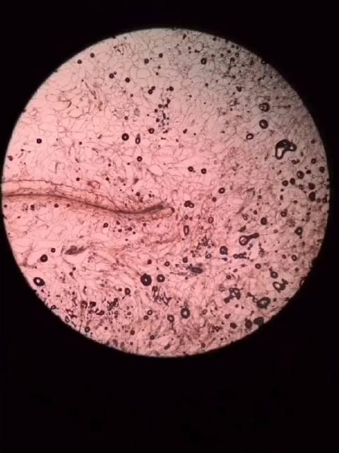 腐烂的香蕉,还舍不得扔吗?看看显微镜下烂香蕉好的那部分