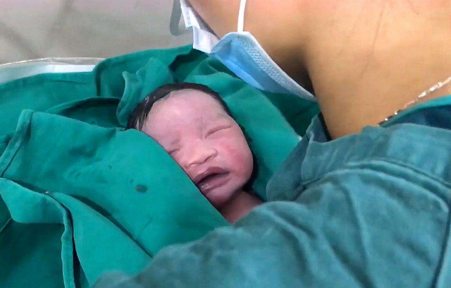 新生儿全身涂满"猪油",母子相见吓坏产妇!医生:这是好事