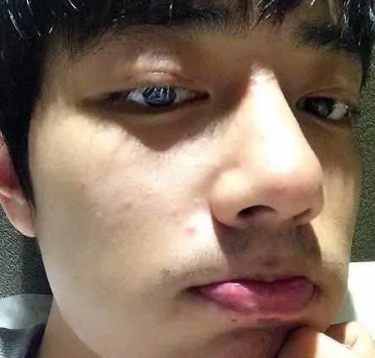 肖战再陷整容风波整容医生被扒出院长出面回应了