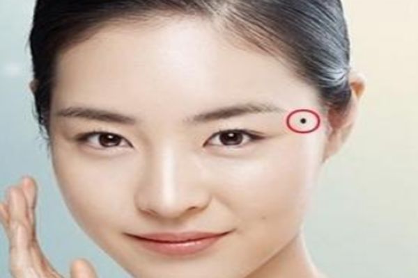 女人太阳穴长痣是好是坏关系到你中年以后的命运都看看吧