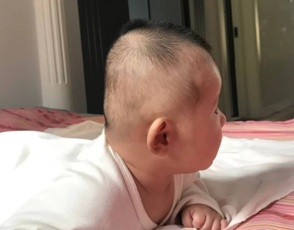扁头真的好看吗平板电脑似的后脑勺可能悄悄影响宝宝智力