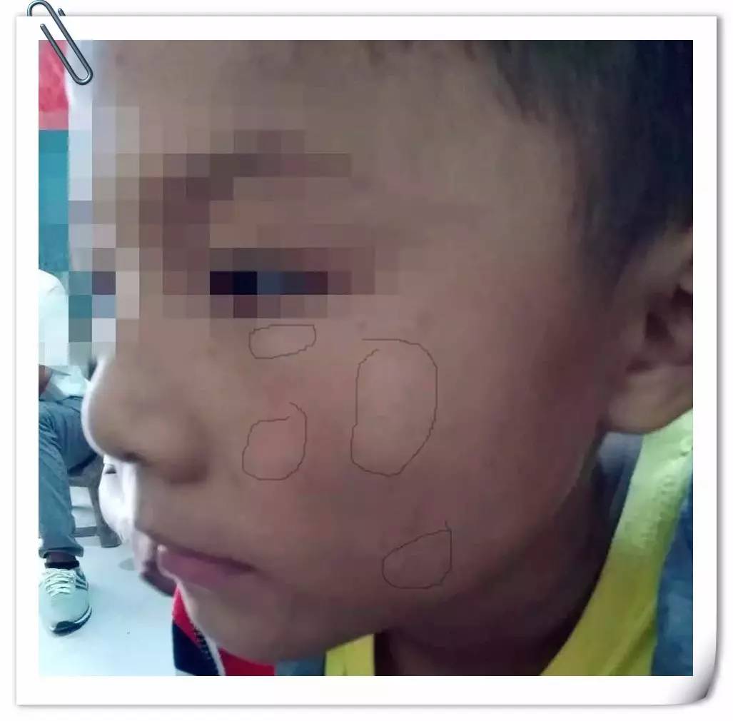 如何判断孩子身体里有积滞?