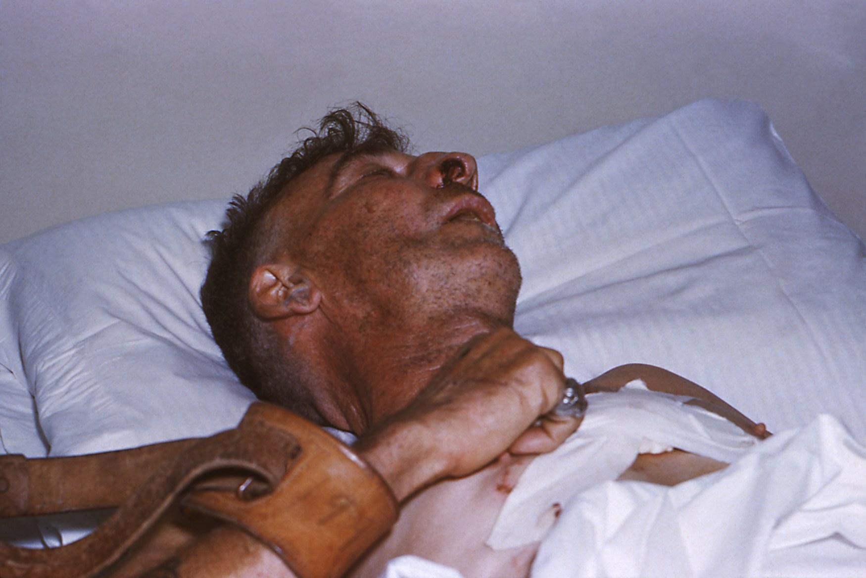 古人没狂犬疫苗,被狗咬了咋办?中医早有土方,已流传1800年|狂犬|传染