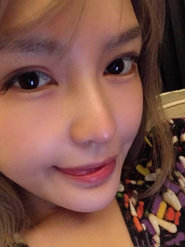 周扬青晒十八宫格怼脸照,自诩18岁美少女,眼部整容痕迹明显