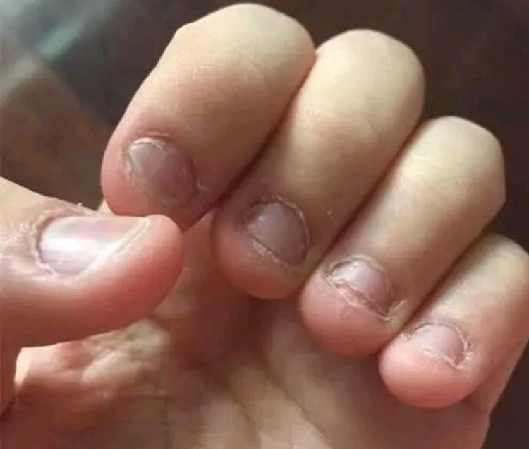 妈妈要了解|咬指甲|指甲|手指甲_新浪新闻