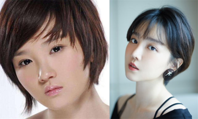 推骨近10次变精致小脸走红堪称被整形改变的命运