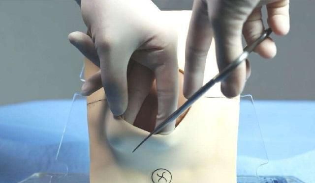 同样都是顺产,为什么国外的宝妈却很少"侧切"?两个差异很明显