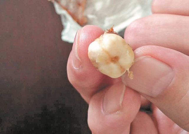 带鱼|骨节|牙齿_新浪新闻