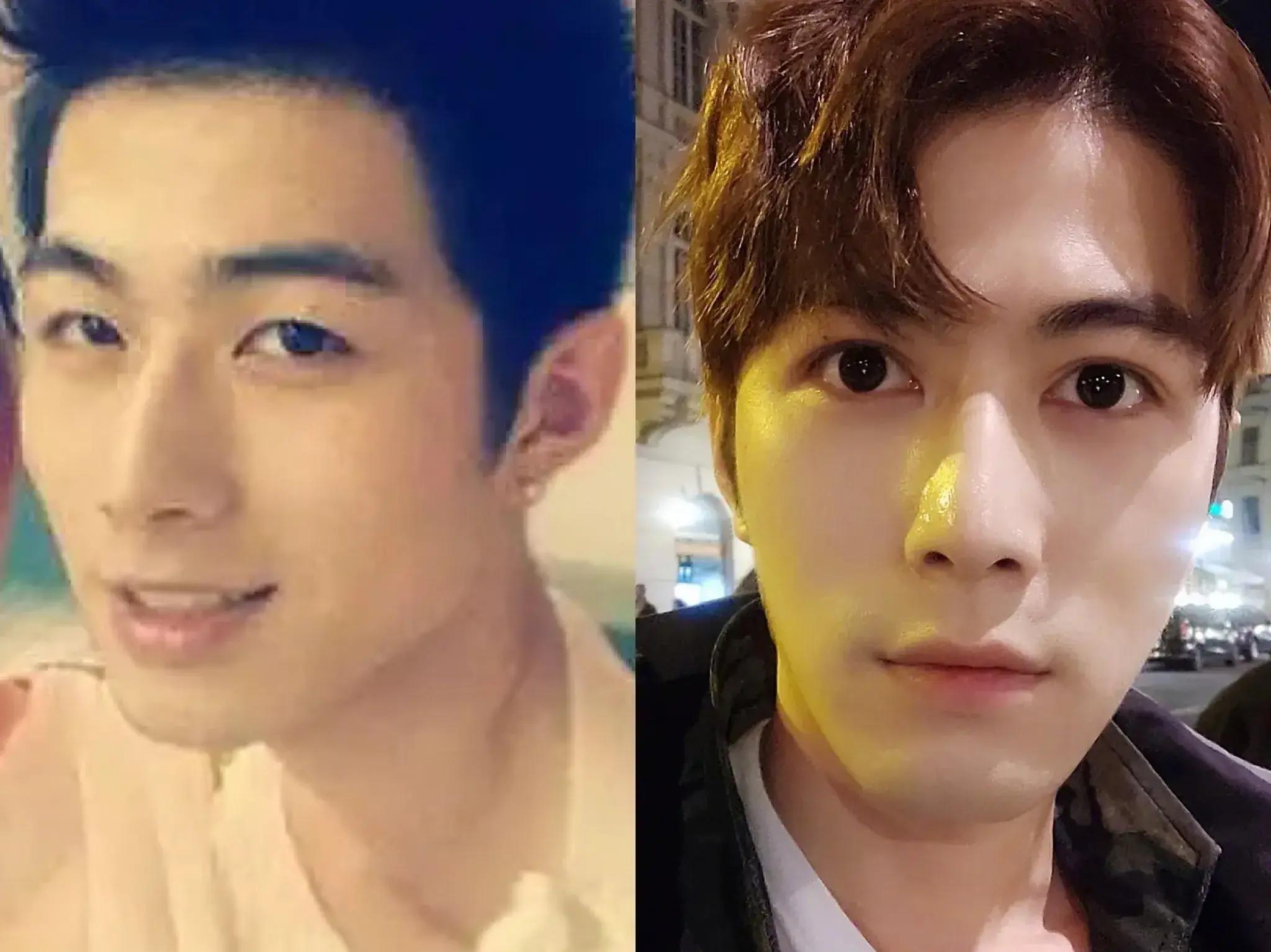 男明星也整容?从这几位整容男明星里发现共同点