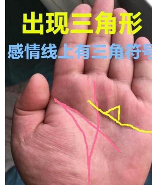 大拇指有"此纹",不论男女,一辈子偏财运极佳,买啥啥就中大奖