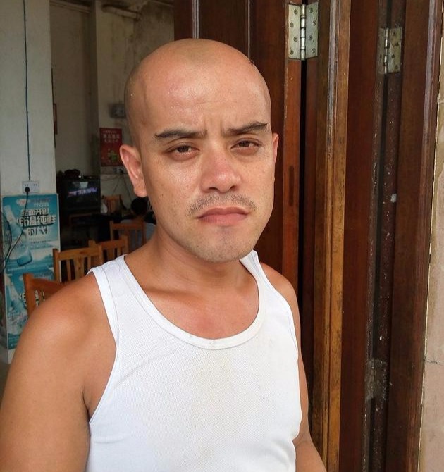 那个长得像光头强的大叔走红后买豪车娶娇妻后来怎样