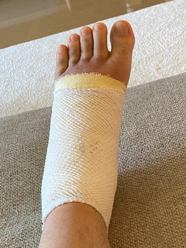 59岁庾澄庆扭伤脚肿似肉包做鬼脸掩饰满脸憔悴