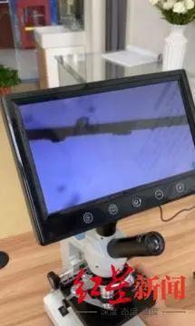 90后女生眼睛干涩发痒,睫毛上发现螨虫!医生:或因宠物猫感染休闲区蓝鸢梦想 - Www.slyday.coM 90后女生眼睛干涩发痒,睫毛上发现螨虫!医生:或因宠物猫感染休闲区蓝鸢梦想 - Www.slyday.coM