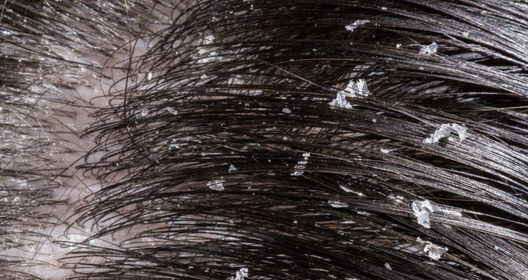 清洁发丝香氛洗发水