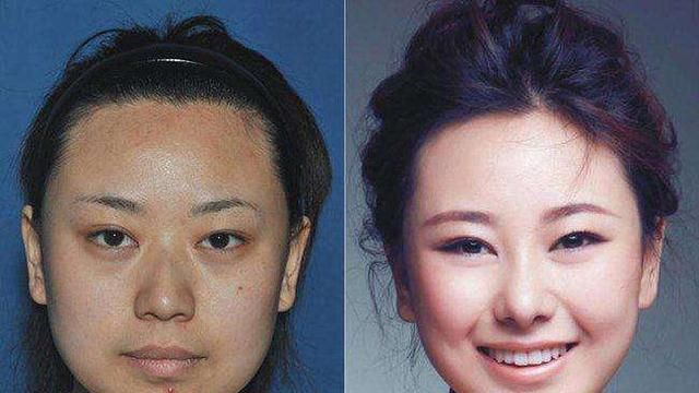 看一看整容前和整容后照片对比,你就知道美女是怎么变成的