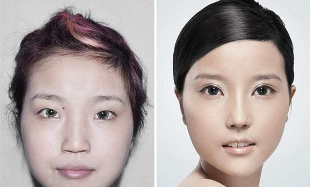 看一看整容前和整容后照片对比,你就知道美女是怎么变成的