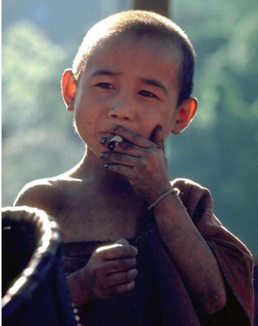 学龄前小男孩是老烟民一天竟然要吸两包烟现在怎么样了