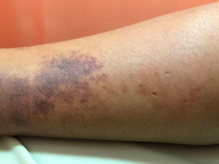 想要避免拉伤,这些细节不可忽视,做好了就能健身无伤!