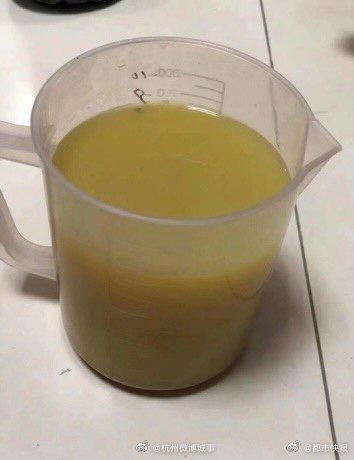 每天吃外卖女孩血像猪油冻 很可能要和糖尿病“共度一生”了休闲区蓝鸢梦想 - Www.slyday.coM