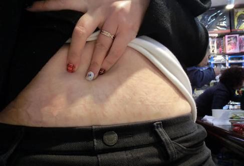 腰粗屁股大女性在生完孩子后屁股会变大是在所难免的,因为在生孩子的