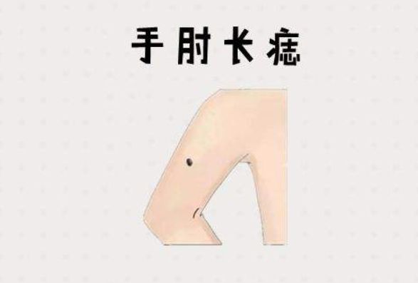 1,手肘外长痣手肘外长痣的人一般赚钱能力强,会理财,因此即使收入不是