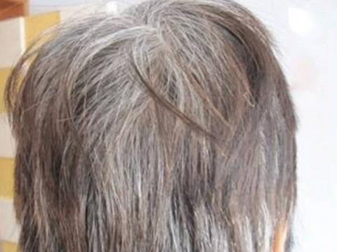 养发有奇方乌发方65岁奶奶秒变阿姨一定要收藏