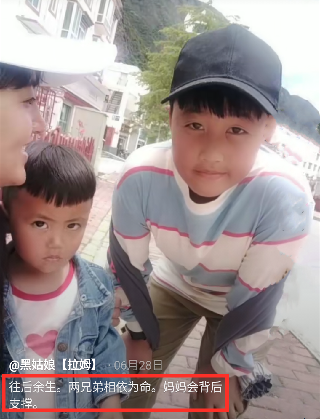 直播时被泼油焚烧,躺病床焦黑一片仍垂危|烧伤|拉姆|前夫_新浪新闻