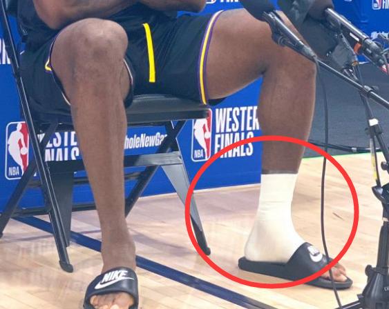 不乐观詹姆斯突破扭伤脚踝赛后接受采访时谁注意他的左脚了