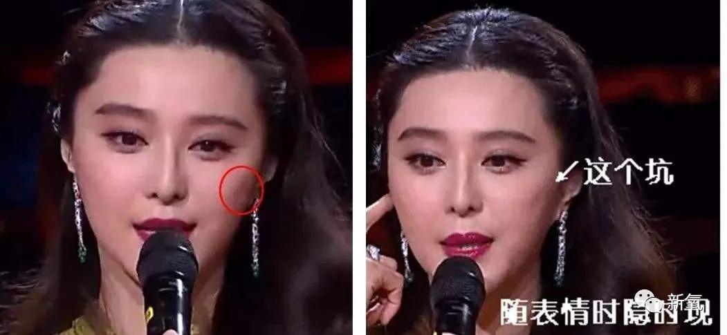 半个娱乐圈女明星脸上都有的这个坑真的是线雕的锅吗