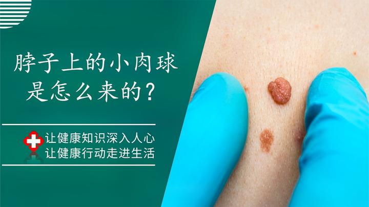 它们对身体有危害吗?医生:可别忽视