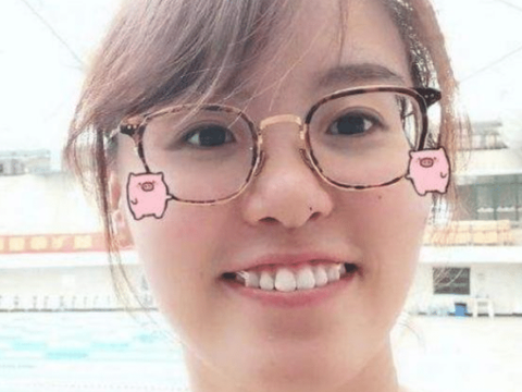 傅园慧整牙后判若两人,网友:看来baby没有说谎