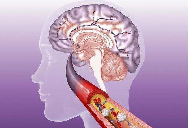 50岁夫妇先后查出脑梗,掩面痛哭,医生:年龄大了1物要少吃休闲区蓝鸢梦想 - Www.slyday.coM 50岁夫妇先后查出脑梗,掩面痛哭,医生:年龄大了1物要少吃休闲区蓝鸢梦想 - Www.slyday.coM