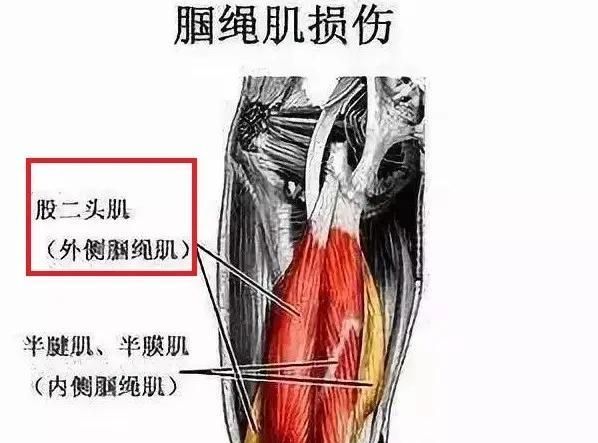 俱乐部在第一时间公布了奥古斯托的伤情鉴定,右侧股二头肌肌腱拉伤