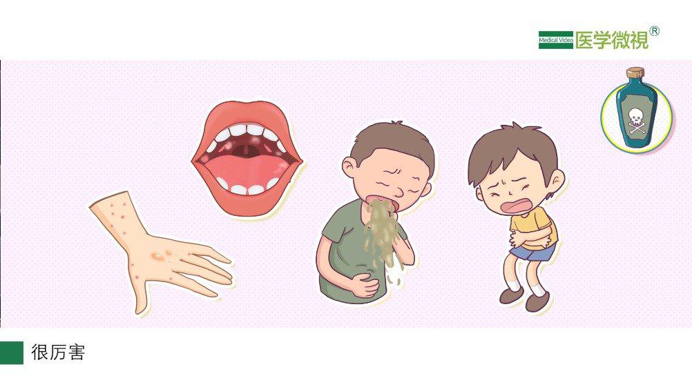 百草枯,敌草快中毒,有什么症状表现?