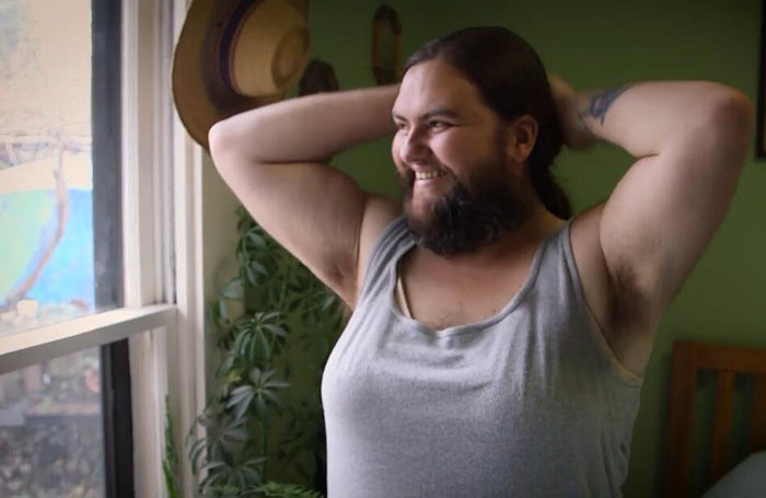 女子从13岁开始长胡子和胸毛,如今到了结婚年龄,却嫁不出去