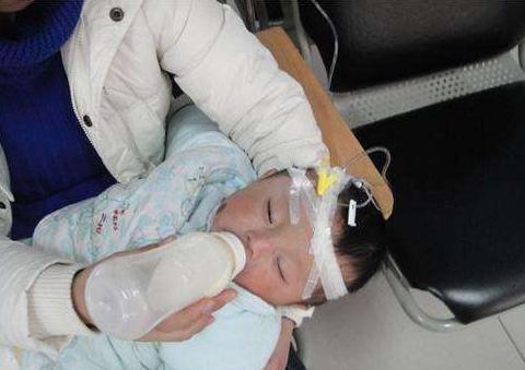 带宝宝输液为啥针头要扎在头上原因医生不会细说家长要知道