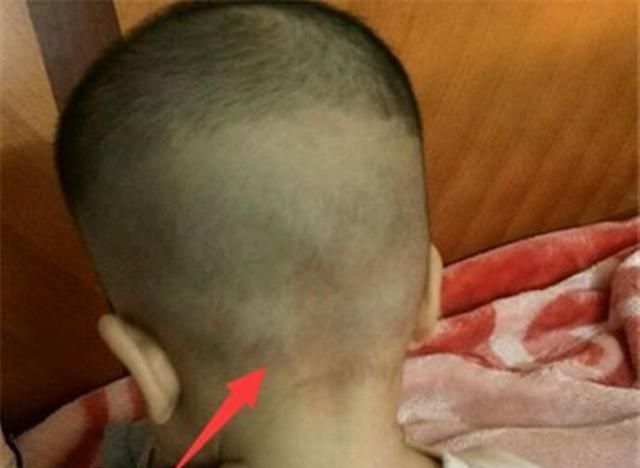 医生:和你想的不一样|囟门|婴儿|宝宝_新浪新闻