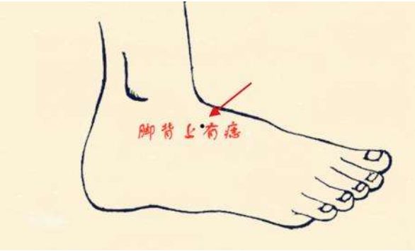 脚背痣脚心有痣,代表了此人天生脚踩富贵,脚背有痣,说明跟财富有距离