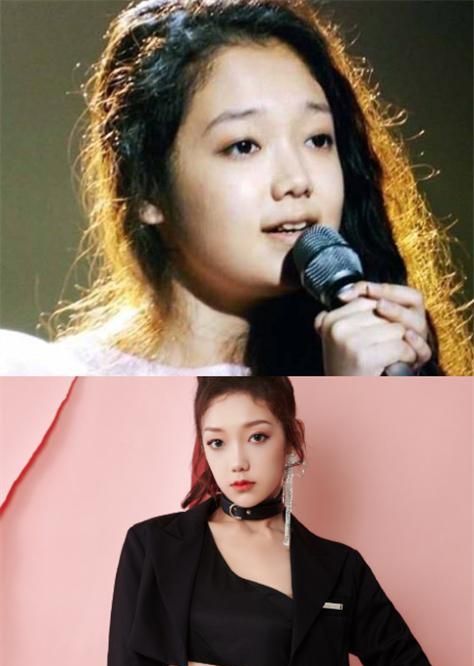 先讲下王艺瑾,这么完美无缺的女生,之前竟然有张十分普通的脸.