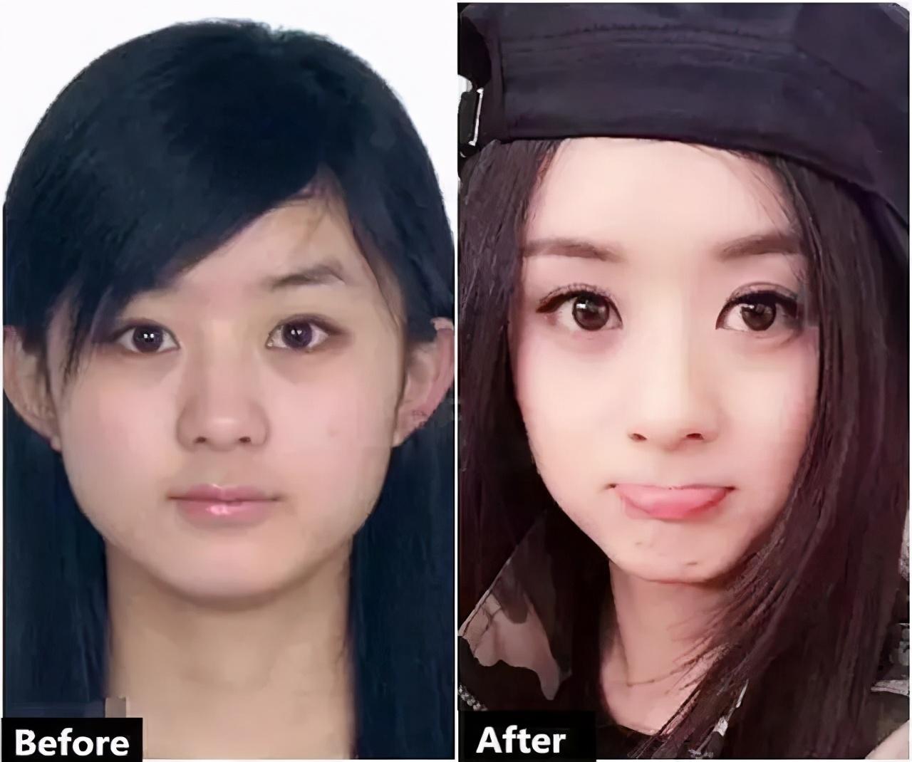 赵丽颖非纯天然美女?黑粉晒图力证做正颌手术,网友看后质疑整容