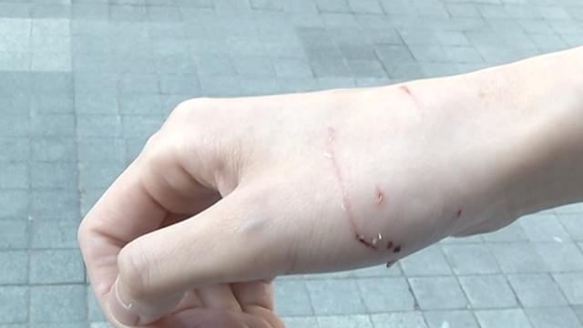 女子私人影咖撸猫被咬成三级伤 商家只肯赔一半医药费