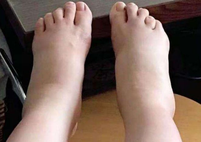 首先,如果你的脚出现脚底抽筋的状况,或者是脚底很容易发麻,次数还