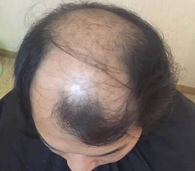 尤其是现在这个秋天黄叶落地的季节,每次洗头时头发和秋叶一样大把的