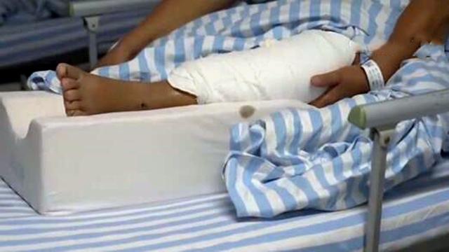 在国外做断骨增高手术导致双腿感染22岁患者恐终身残疾