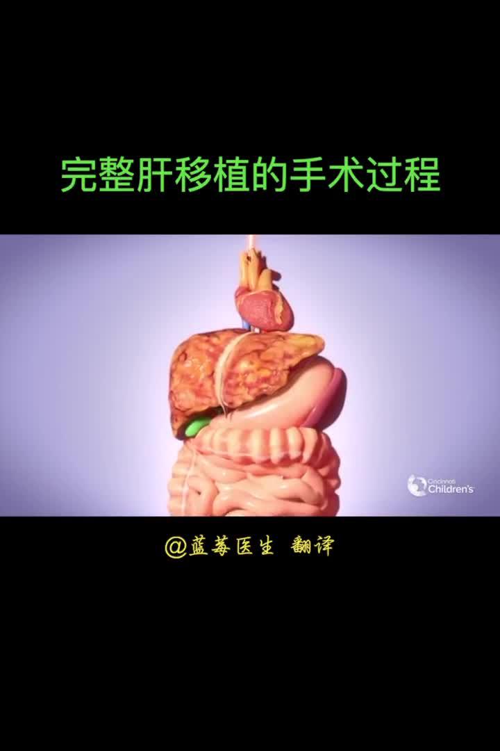 肝移植的手术过程