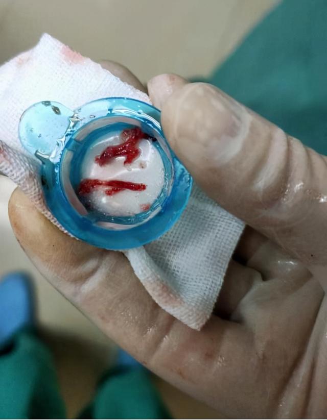 年轻小伙一月两次突发心梗,专家:这些不良生活习惯要注意|心肌梗死_新