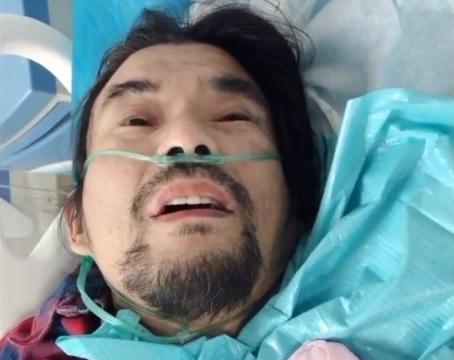 面筋哥患肺癌晚期接受手术,整个人已经瘦到完全脱相