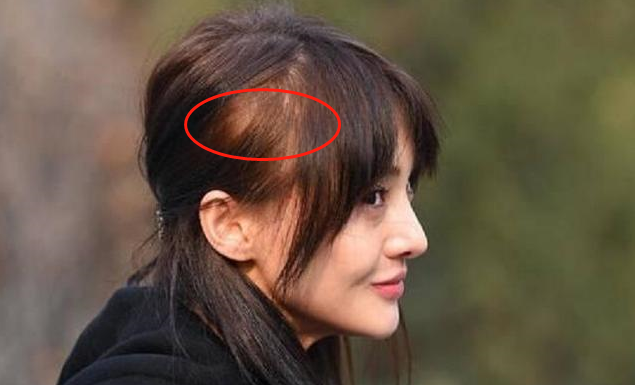 郑爽素颜憔悴邋遢,发型凌乱又秃又躁,头发稀疏似小老太