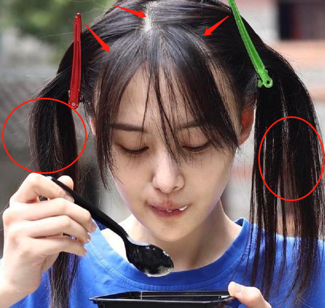 郑爽素颜憔悴邋遢,发型凌乱又秃又躁,头发稀疏似小老太