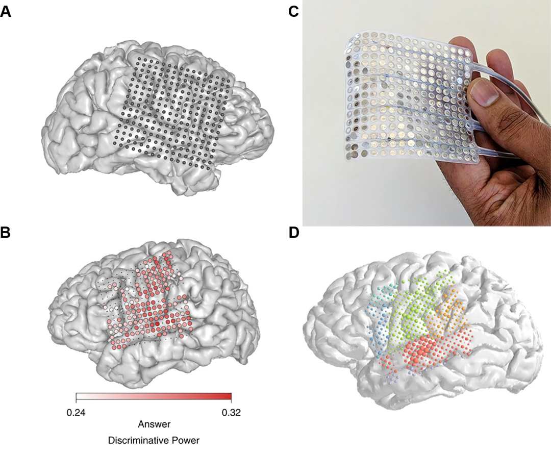 256通道高密度ecog电极及其植入位置示意魔法帽还在路上edward chang